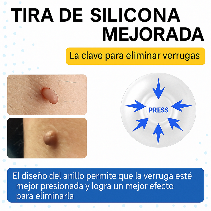 Kit Removedor De Verrugas